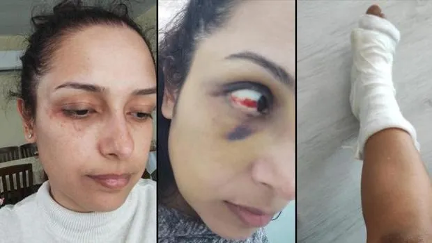 Adana'da genç öğretmenin hayatı kabusa döndü! 'Hamileyken dövdü, ayağım kırıldı, bebeğimi kaçırdı'