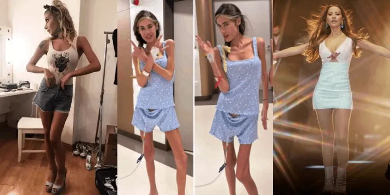 Derya Uluğ'dan Anoreksiya İtirafı! Ünlüler ve Yeme Bozuklukları