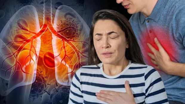 İstanbul, Ankara, İzmir Alarm Veriyor! Akciğer Kanseri Riski Artıyor!