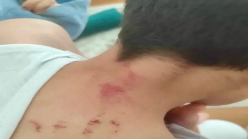Okulda dehşet! Şanlıurfa'da öğrencisini darbeden öğretmen tutuklandı